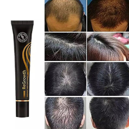 Regrowth™ Serum De Biotina Crece Cabello 20 Ml